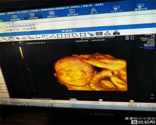 南京不孕不育助孕机构_南京代孕联系方式是多少_怀孕三四天就流产的原因是什么