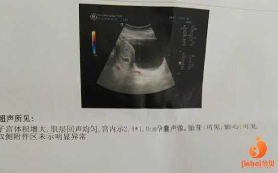 南京代生多少钱,【南京市妇幼供卵试管45岁供卵成功率】因为是顺转刨意外情况